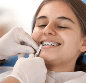 Exploring Orthodontic Dental Clinics - Your Comprehensive Guide