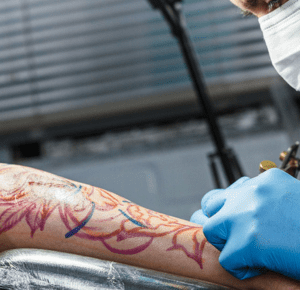 Getting a Tattoo Before Surgery - What You Need to Know
