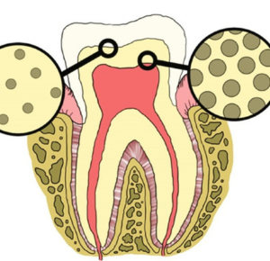 Exploring the Latest Edition of Grossman Endodontics - A Comprehensive Overview