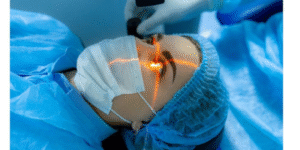 LASIK 