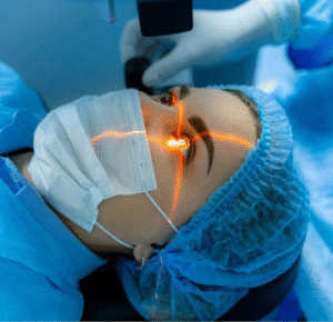 LASIK 