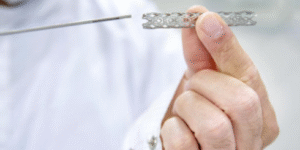 angiogram specialist in Coimbatore