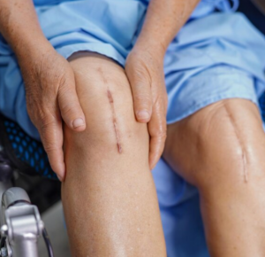 best ortho hospital in Coimbatore